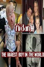 Watch Aidan The Rarest Boy In The World Wootly