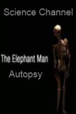 Watch Science Channel Elephant Man Autopsy Wootly