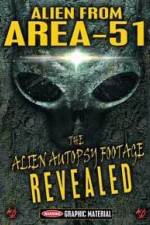 Watch Alien from Area 51 The Alien Autopsy Footage Revealed Wootly