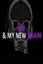 Watch Me & My New Brain Wootly