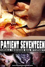 Watch Patient Seventeen Wootly