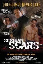 Watch Serbian Scars Wootly