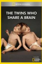 Watch National Geographic The Twins Who Share A Brain Wootly