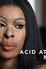 Watch Acid Attack: My Story Wootly