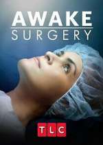 Watch Awake Surgery Wootly