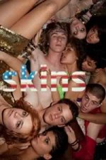 Watch Skins (US) Wootly