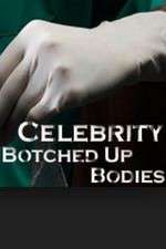 Watch Celebrity Botched Up Bodies Wootly